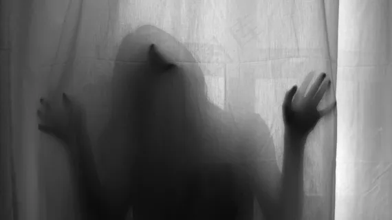 关节X线照片,凳子,手,咬翼片,马蹄莲,莎乐美的舞蹈