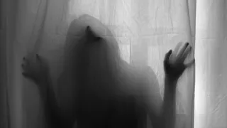 关节X线照片,凳子,手,咬翼片,马蹄莲,莎乐美的舞蹈