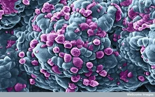 B0008734纳米尺寸处理的乳腺癌细胞