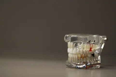 牙科,牙齿,牙齿,模型,颚,口腔,护理 牙科,牙齿,牙齿,模型,颚,口腔,护理