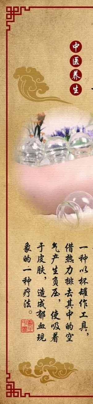中医养生拔罐展板图片