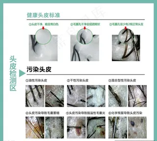 头皮检测图片