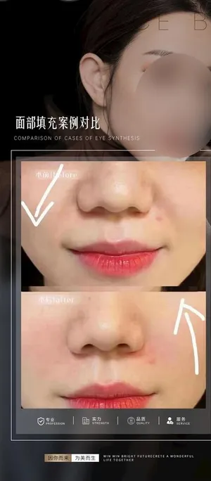 医美案例对比海报图片