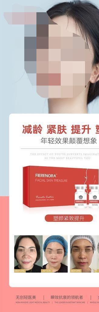 提升针 瓜子脸 侧颜图片