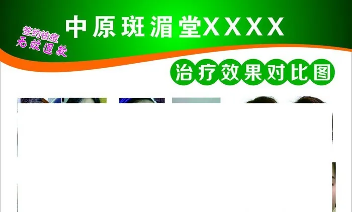 祛斑效果对比图图片cdr矢量模版下载