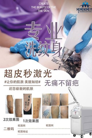 专业洗纹身图片