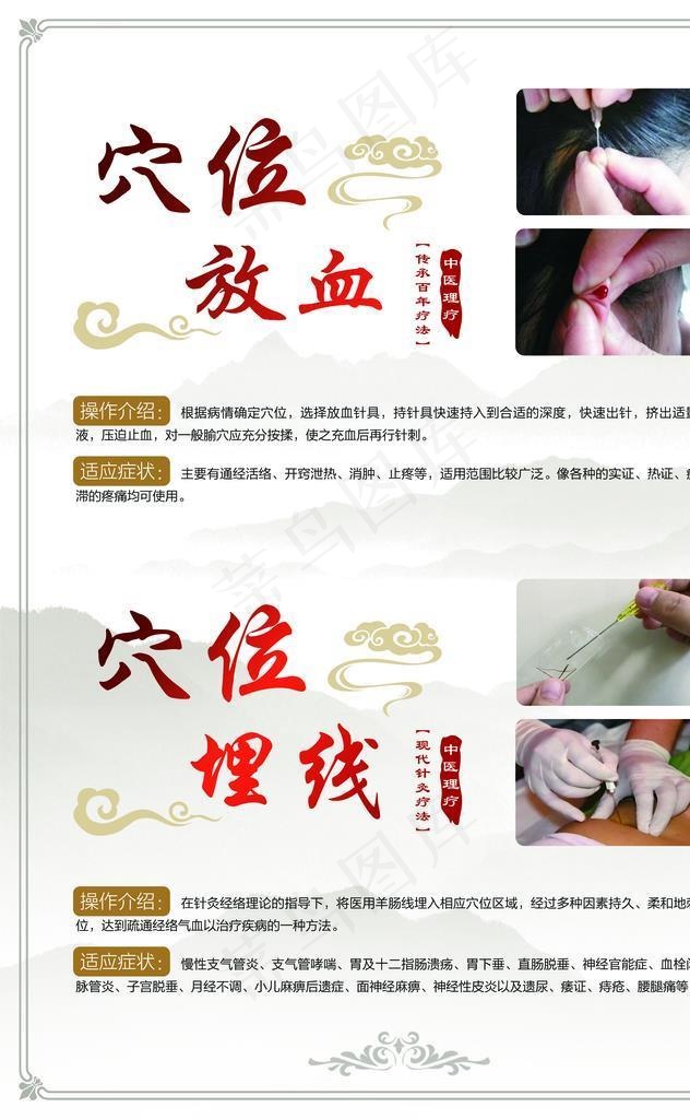 穴位放血穴位埋线图片(4429x6201)psd模版下载