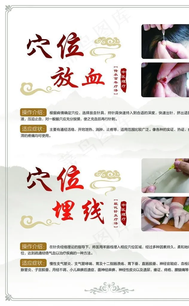 穴位放血穴位埋线图片(4429x6201)psd模版下载