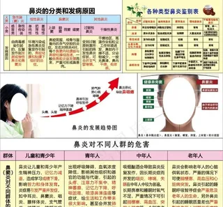 鼻炎的分类和发病原因图片